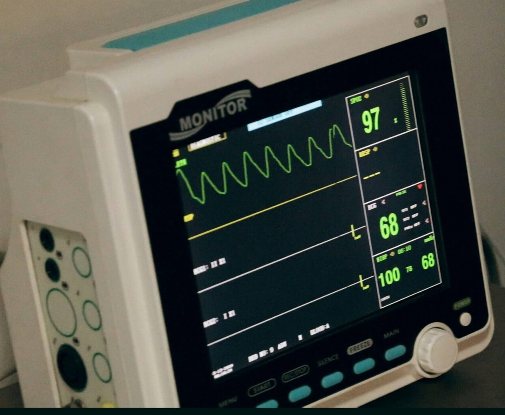 A picture of a white heart monitor typically found in hospital or surgery rooms it has black background on screen with bright green charts and graphs indicating patient vitals